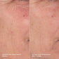 skin aging solutions kit before and after