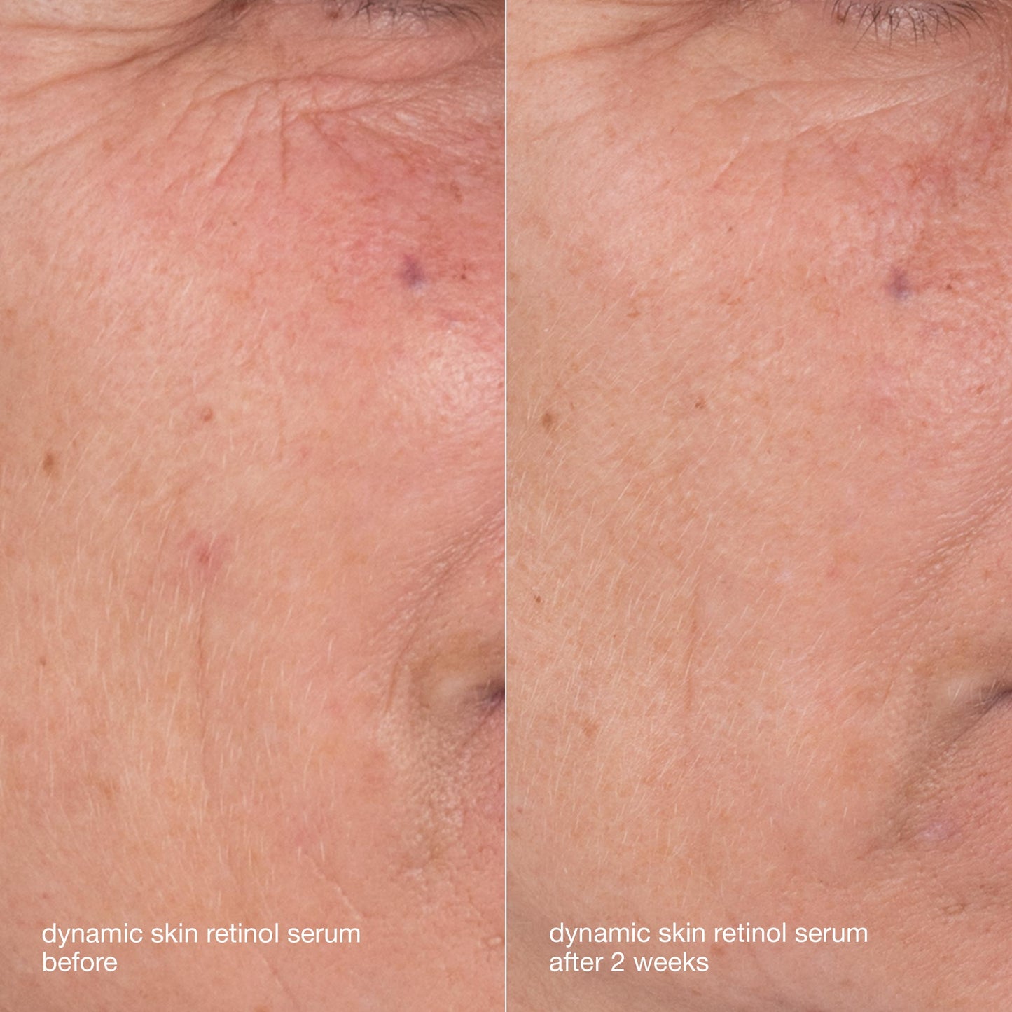 skin aging solutions kit before and after 