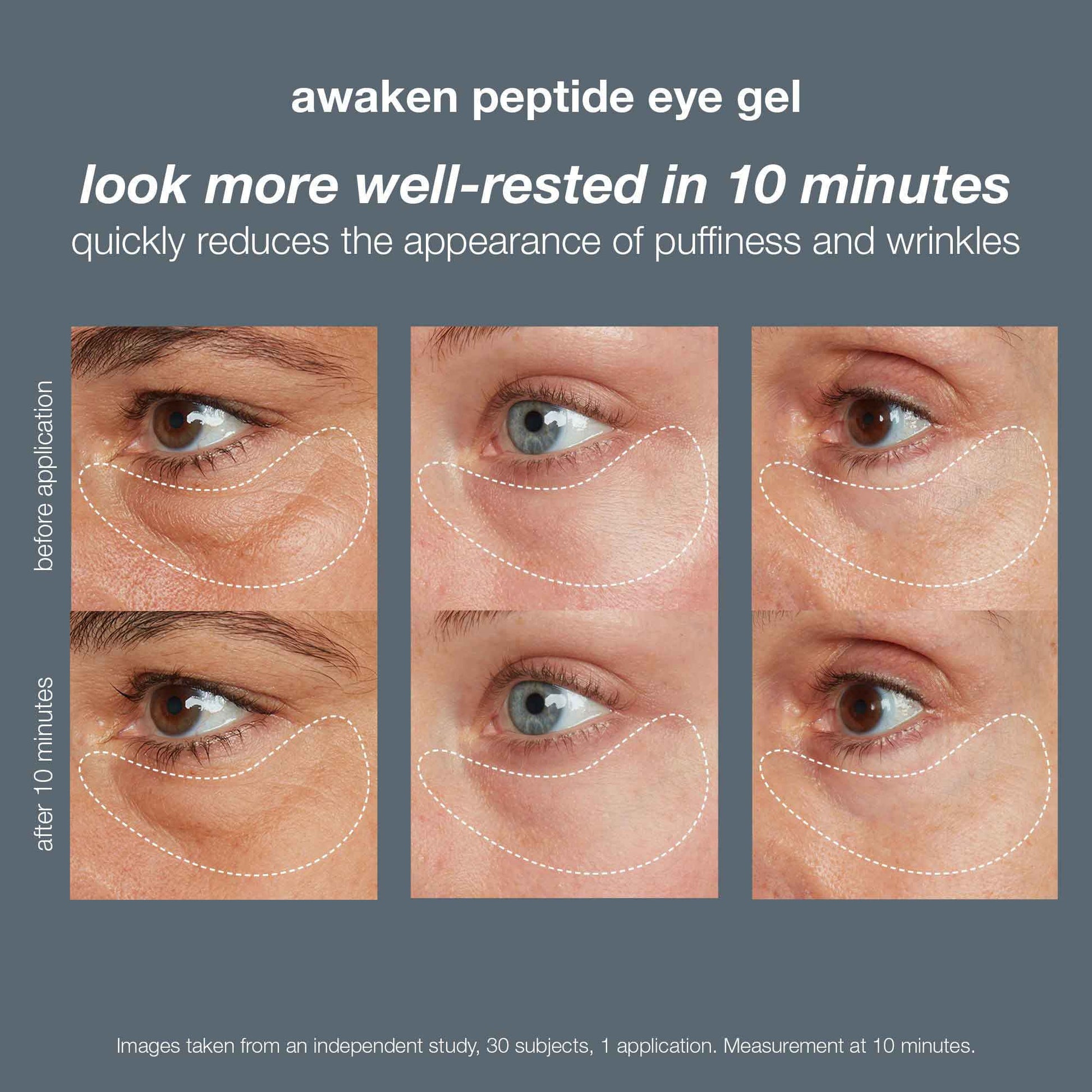 Under-Eye Toning Gel — stimulating eye gel to leave eyes feeling awake and  refreshed. Combats dark circles and under-eye puffiness, Cellex-C
